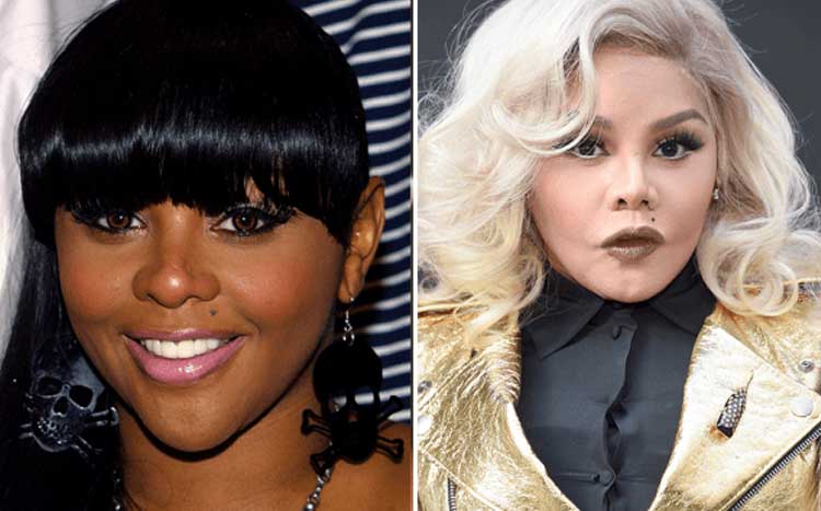 Lil Kim Before and After Plastic Surgery: How Lil Destroyed Her Looks